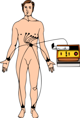 File:ECGcolor.svg